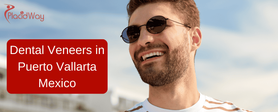 Dental Veneers in Puerto Vallarta Mexico thumbnail
