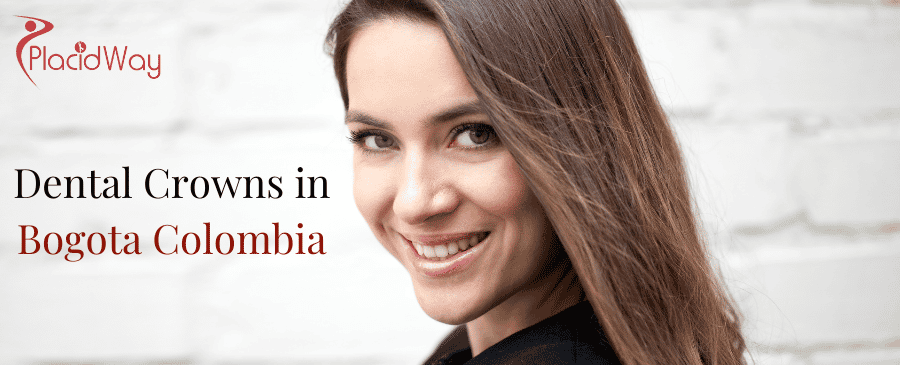 Dental Crowns in Bogota Colombia thumbnail