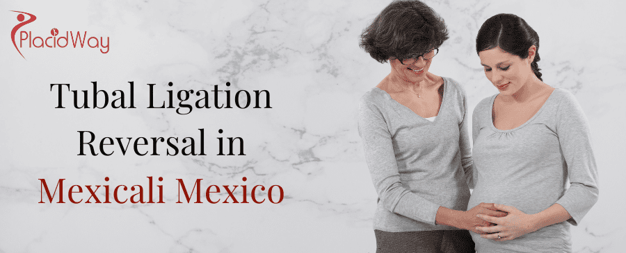 Tubal Ligation Reversal in Mexicali Mexico thumbnail