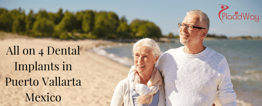 All on 4 Dental Implants in Puerto Vallarta Mexico thumbnail