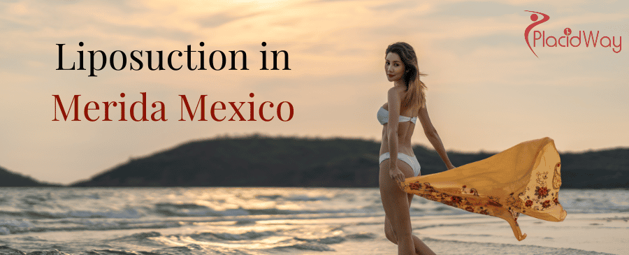 Liposuction in Merida, Mexico thumbnail
