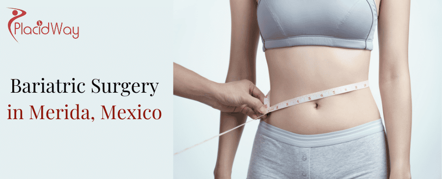 Bariatric Surgery in Merida, Mexico thumbnail