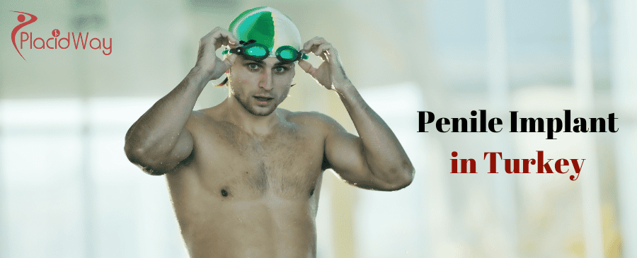 Penile Implant in Turkey thumbnail
