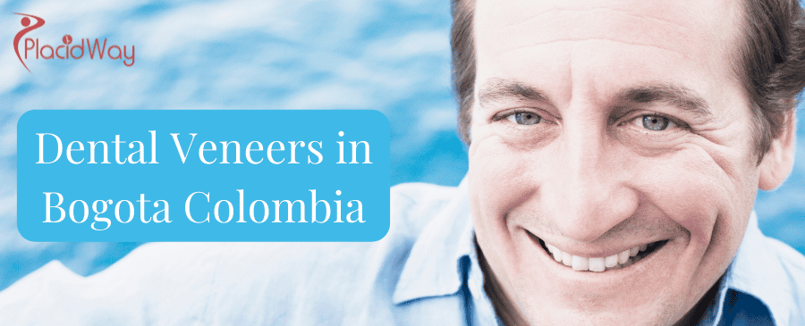 Dental Veneers in Bogota Colombia thumbnail