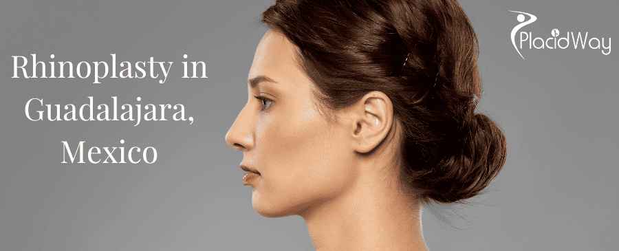 Rhinoplasty in Guadalajara, Mexico thumbnail