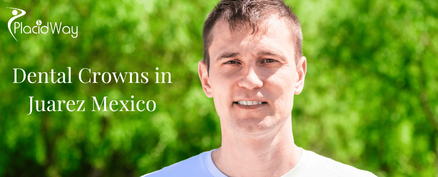 Dental Crowns in Juarez Mexico thumbnail