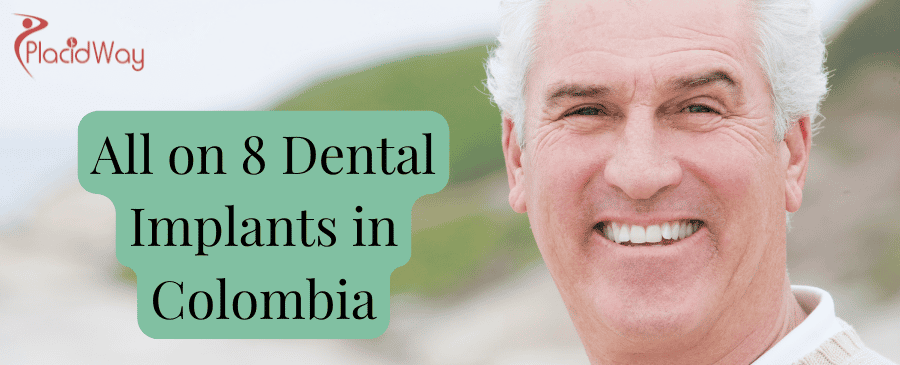 All on 8 Dental Implants in Colombia thumbnail