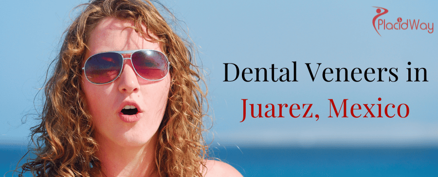 Dental Veneers in Juarez, Mexico thumbnail