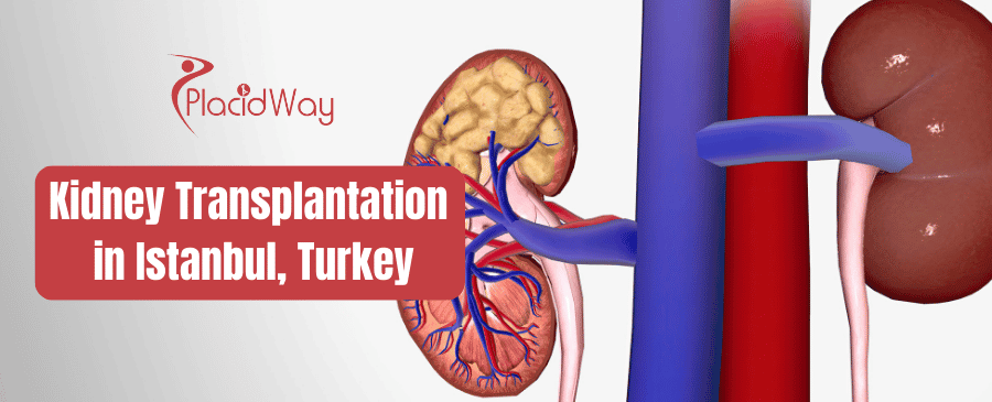 Kidney Transplantation in Istanbul, Turkey thumbnail
