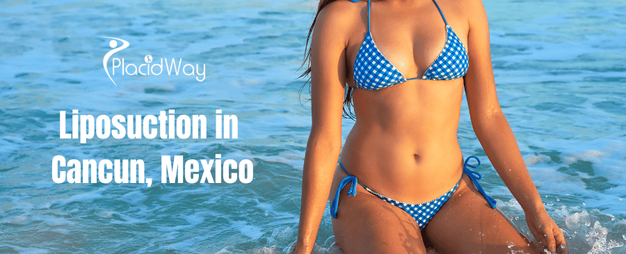 Liposuction in Cancun, Mexico thumbnail