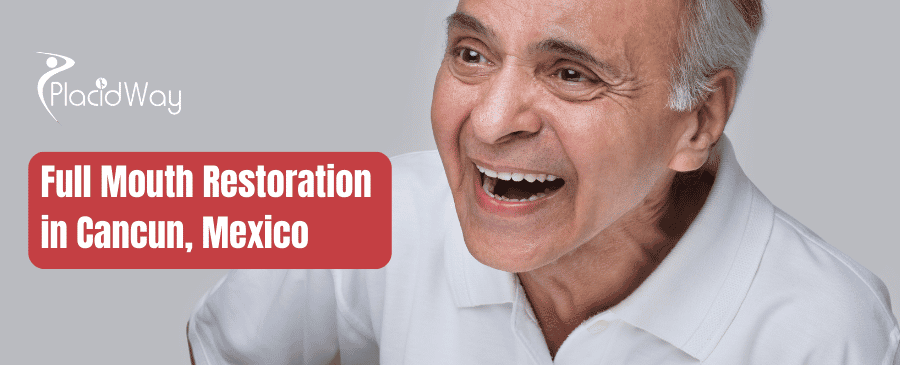 Full Mouth Restoration in Cancun, Mexico thumbnail