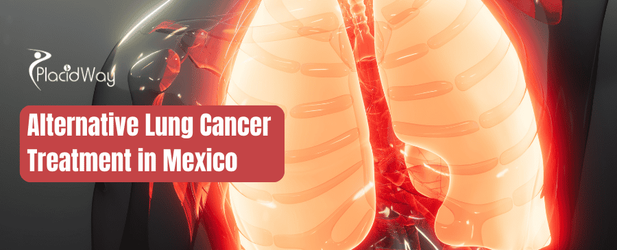 Alternative Lung Cancer Treatment Mexico thumbnail
