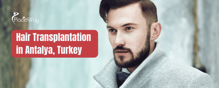 Hair Transplantation in Antalya Turkey thumbnail