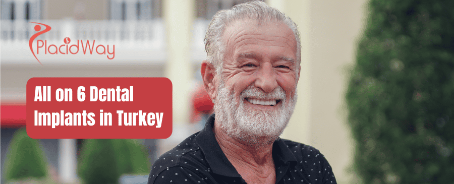 All on 6 Dental Implants in Turkey thumbnail
