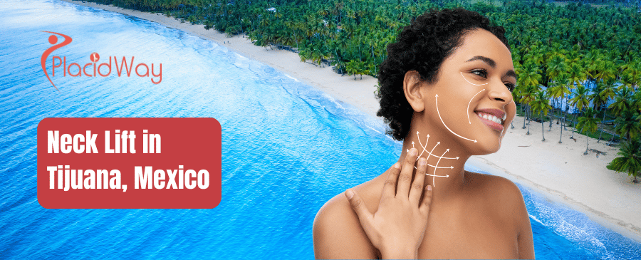 Neck Lift in Tijuana Mexico thumbnail