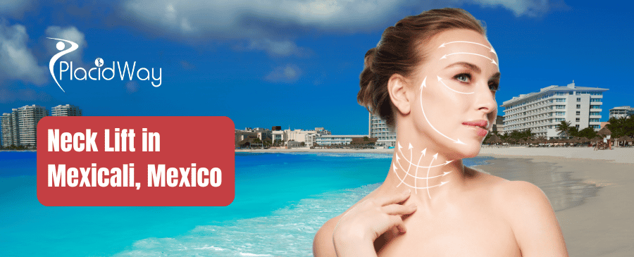 Neck Lift in Mexicali, Mexico thumbnail