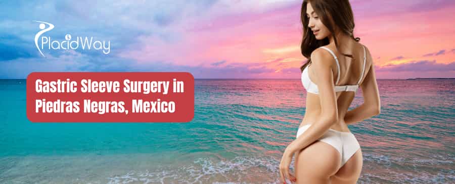 Gastric Sleeve Surgery in Piedras Negras, Mexico thumbnail