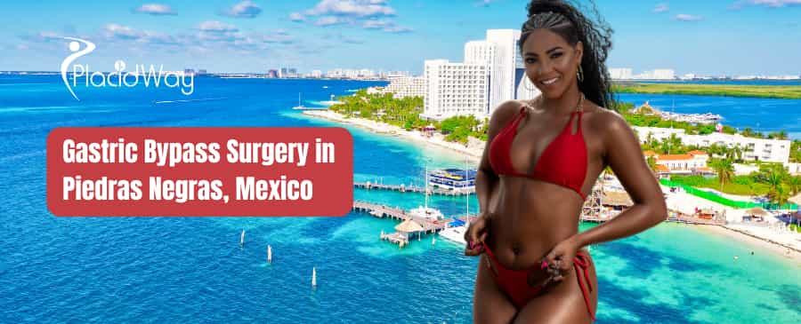 Gastric Bypass Surgery in Piedras Negras, Mexico thumbnail