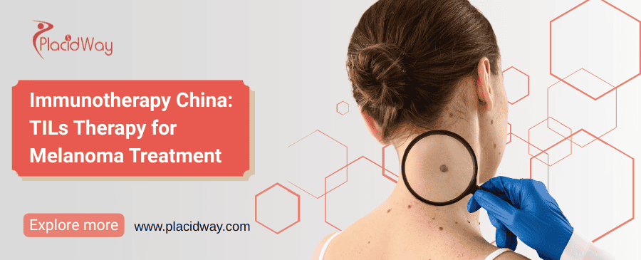 Immunotherapy China: TILs Therapy for Melanoma thumbnail