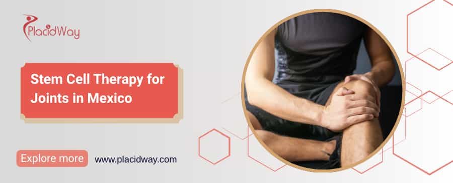 Stem Cell Therapy for Joints in Mexico thumbnail