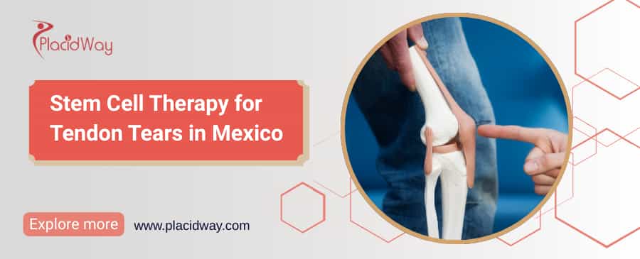 Stem Cell Therapy for Tendon Tears in Mexico thumbnail
