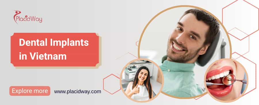 Dental Implants in Vietnam thumbnail