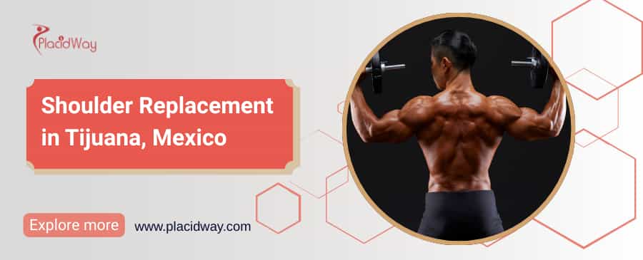 Shoulder Replacement in Tijuana, Mexico thumbnail