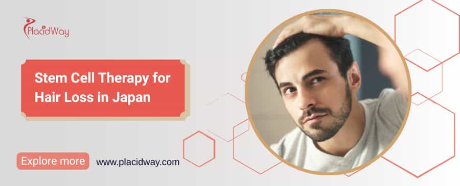 Stem Cell Therapy for Hair Loss in Japan thumbnail