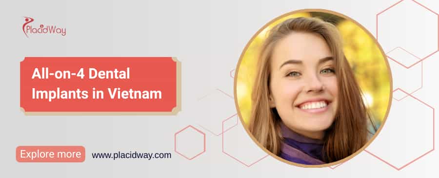All-on-4 Dental Implants in Vietnam thumbnail