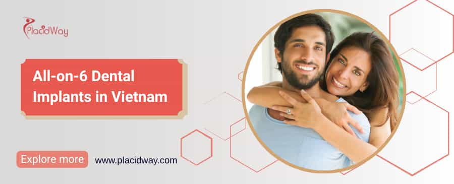 All-on-6 Dental Implants in Vietnam thumbnail