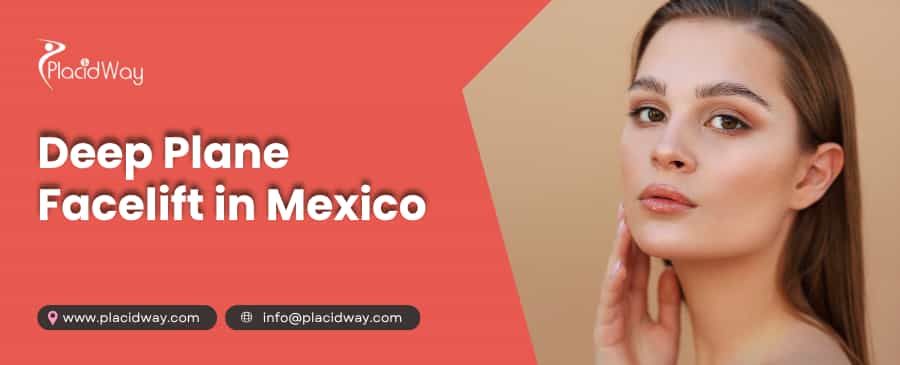 Deep Plane Facelift in Mexico thumbnail