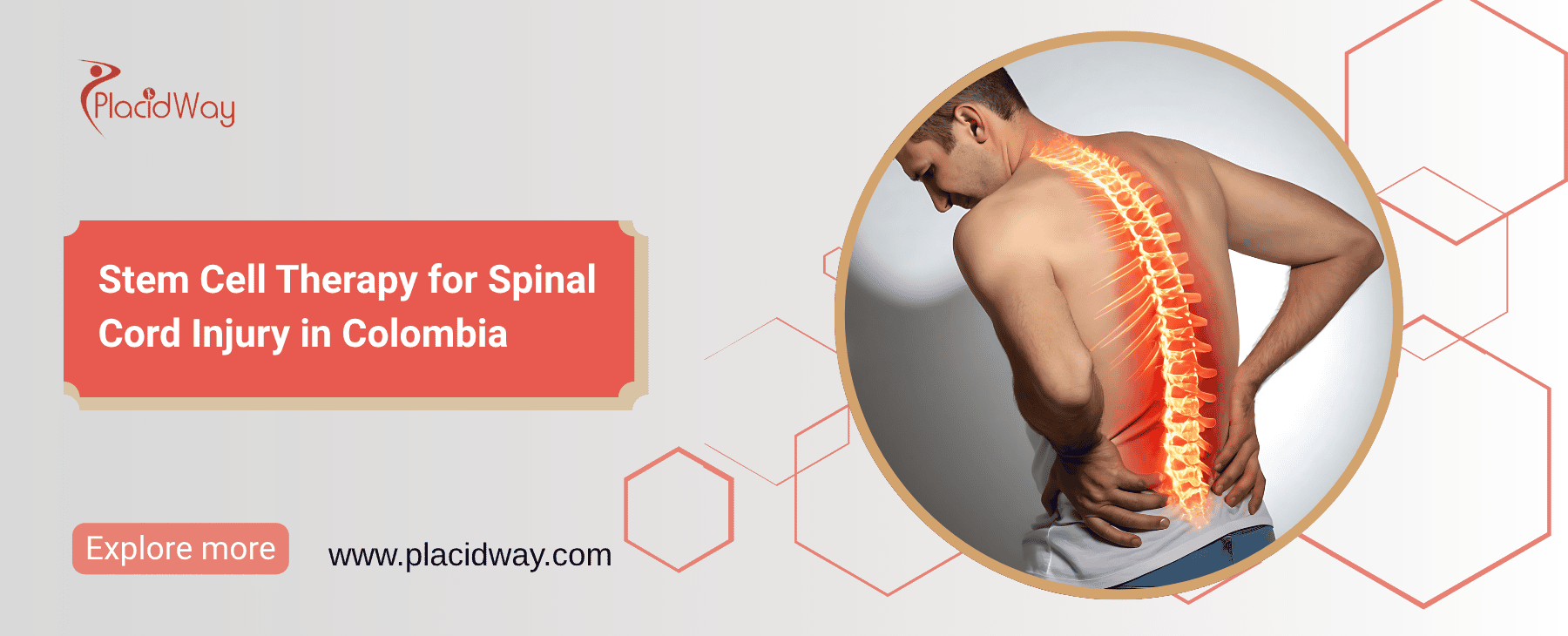 Stem Cell Therapy for Spinal Cord Injury in Colombia thumbnail