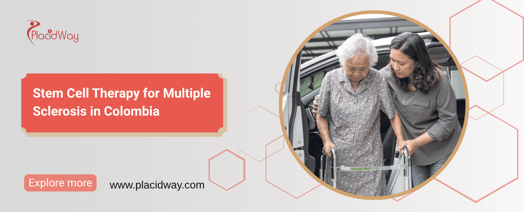 Stem Cell Therapy for Multiple Sclerosis in Colombia thumbnail