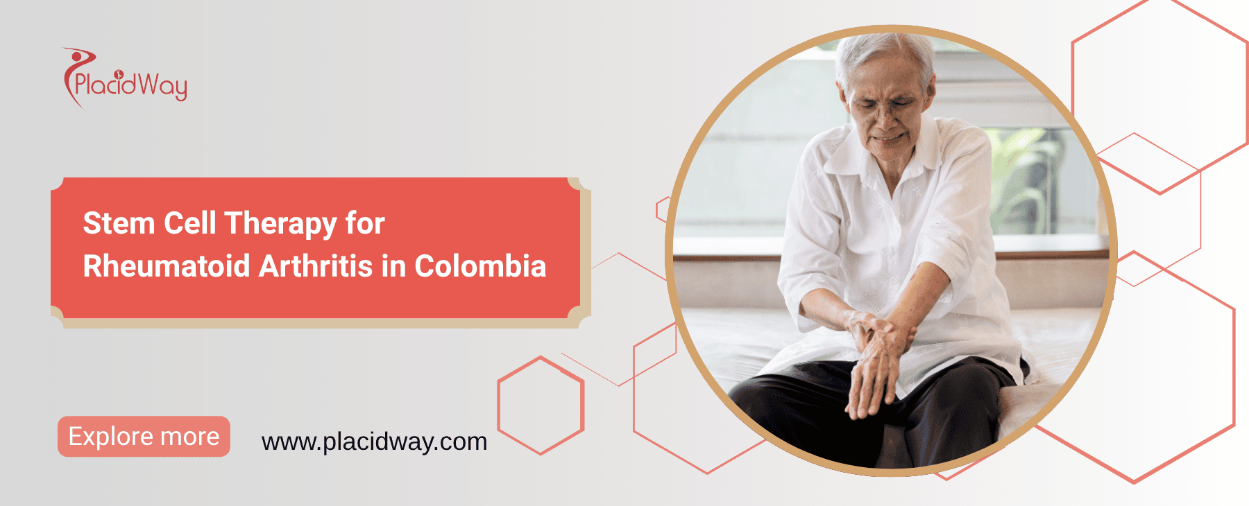 Stem Cell Therapy for Rheumatoid Arthritis in Colombia thumbnail