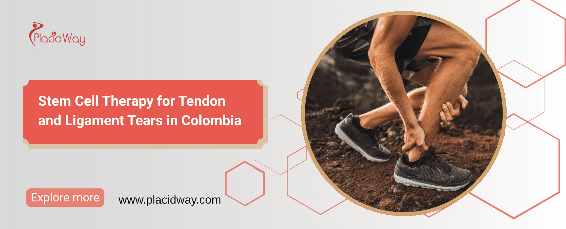 Stem Cell Therapy for Tendon and Ligament Tears in Colombia thumbnail