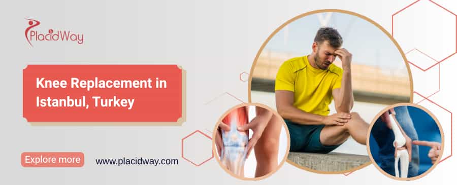 Knee Replacement in Istanbul, Turkey thumbnail