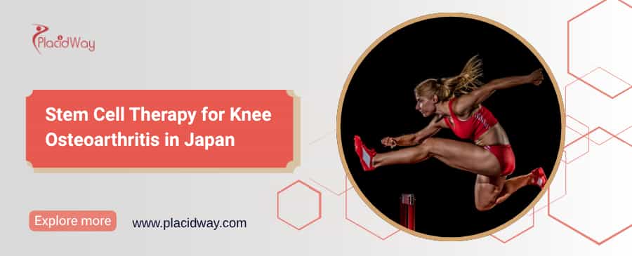 Stem Cell Therapy for Knee Osteoarthritis in Japan thumbnail
