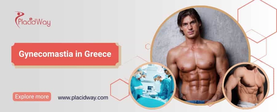Gynecomastia in Greece thumbnail