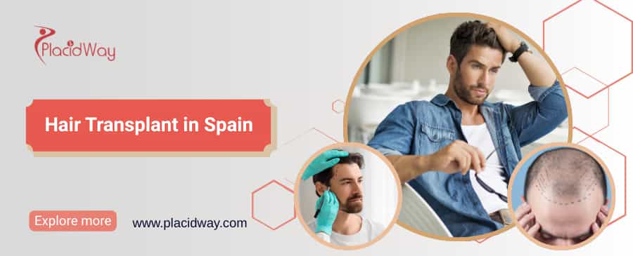 Hair Transplant in Spain thumbnail