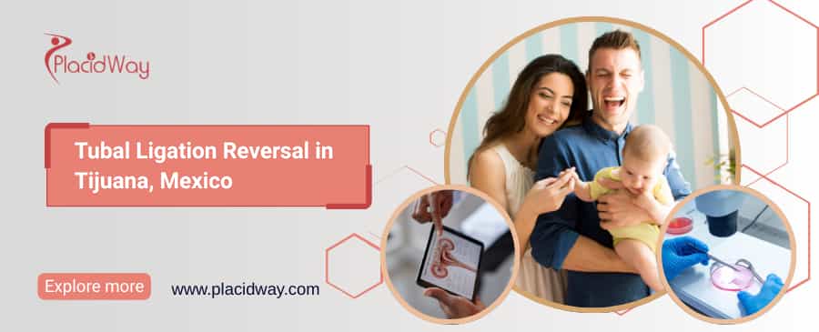 Tubal Ligation Reversal in Tijuana, Mexico thumbnail