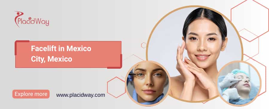 Facelift in Mexico City, Mexico thumbnail