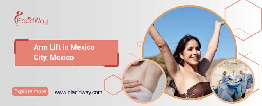 Arm Lift in Mexico City, Mexico thumbnail