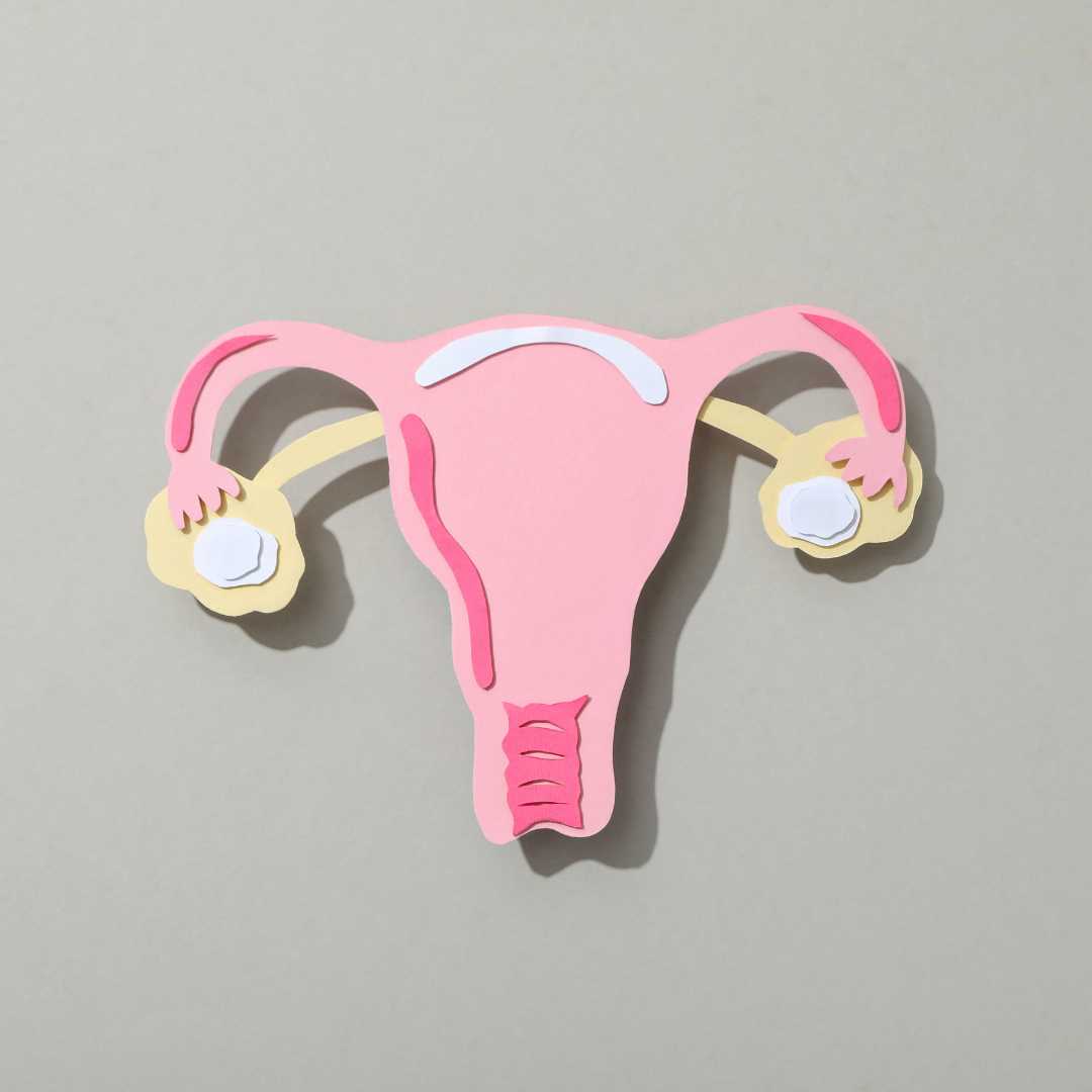 Polycystic Ovary Syndrome (PCOS) and Fertility: How Embryo Transfer in Cyprus Offers New Hope