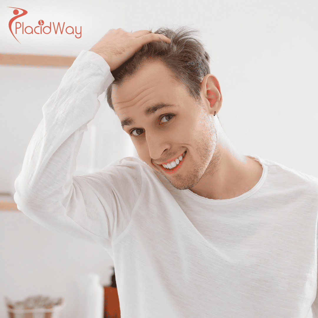 Direct Hair Implantation (DHI) in Turkey: A Complete Guide for Americans Looking for Advanced Hair Restoration