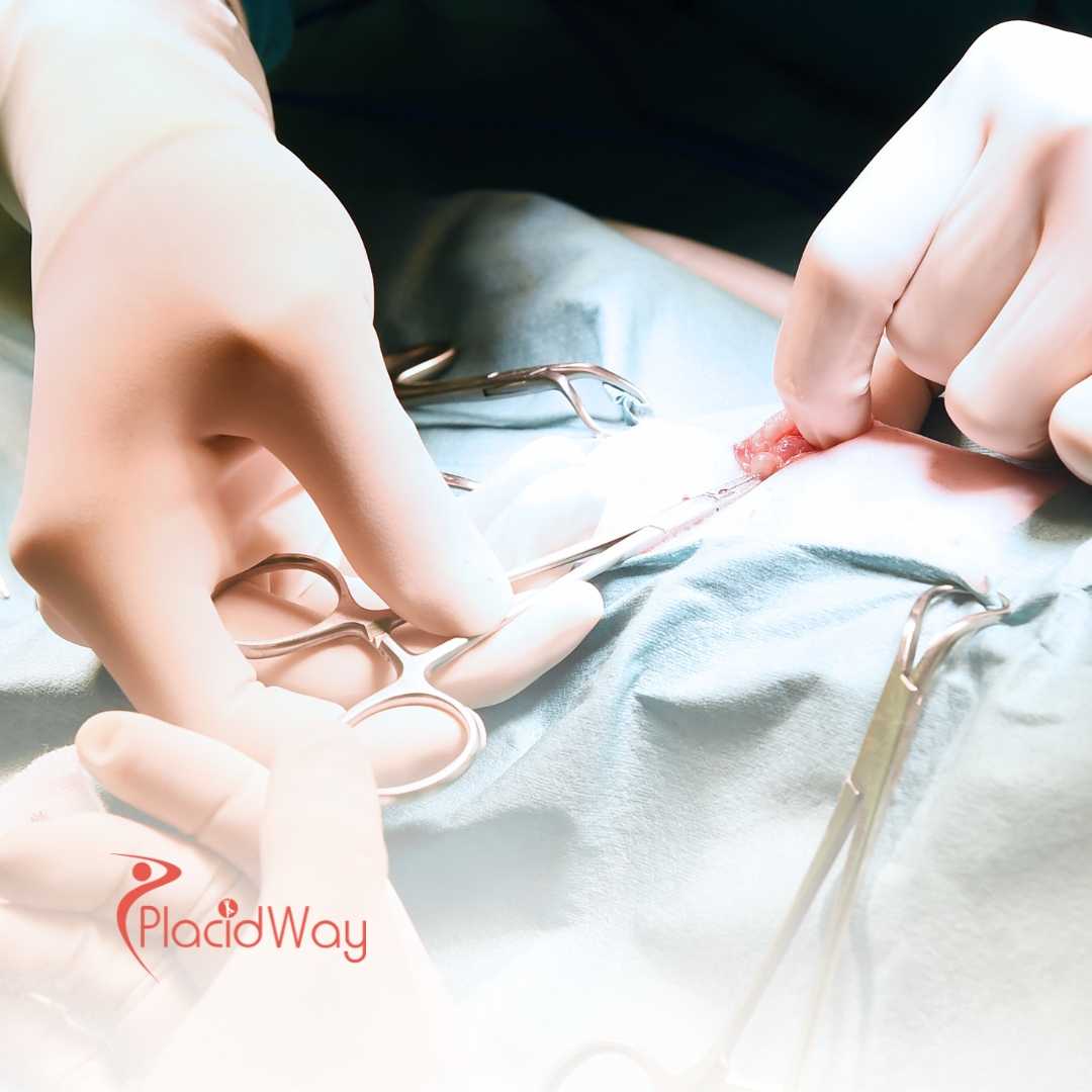 Penile Surgery in Germany: High-Quality Urology Services for Middle Eastern Men with Erectile Dysfunction