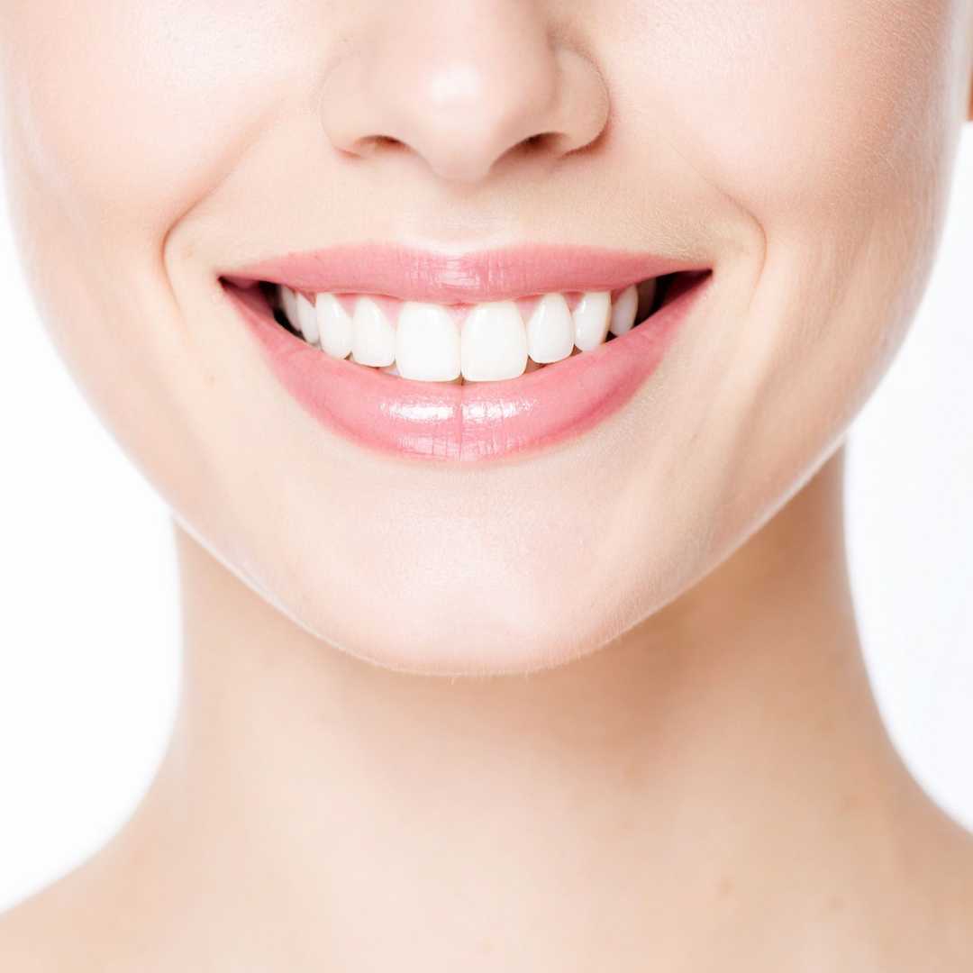 Porcelain Veneers in Mexico vs USA - A Complete Comparison Guide