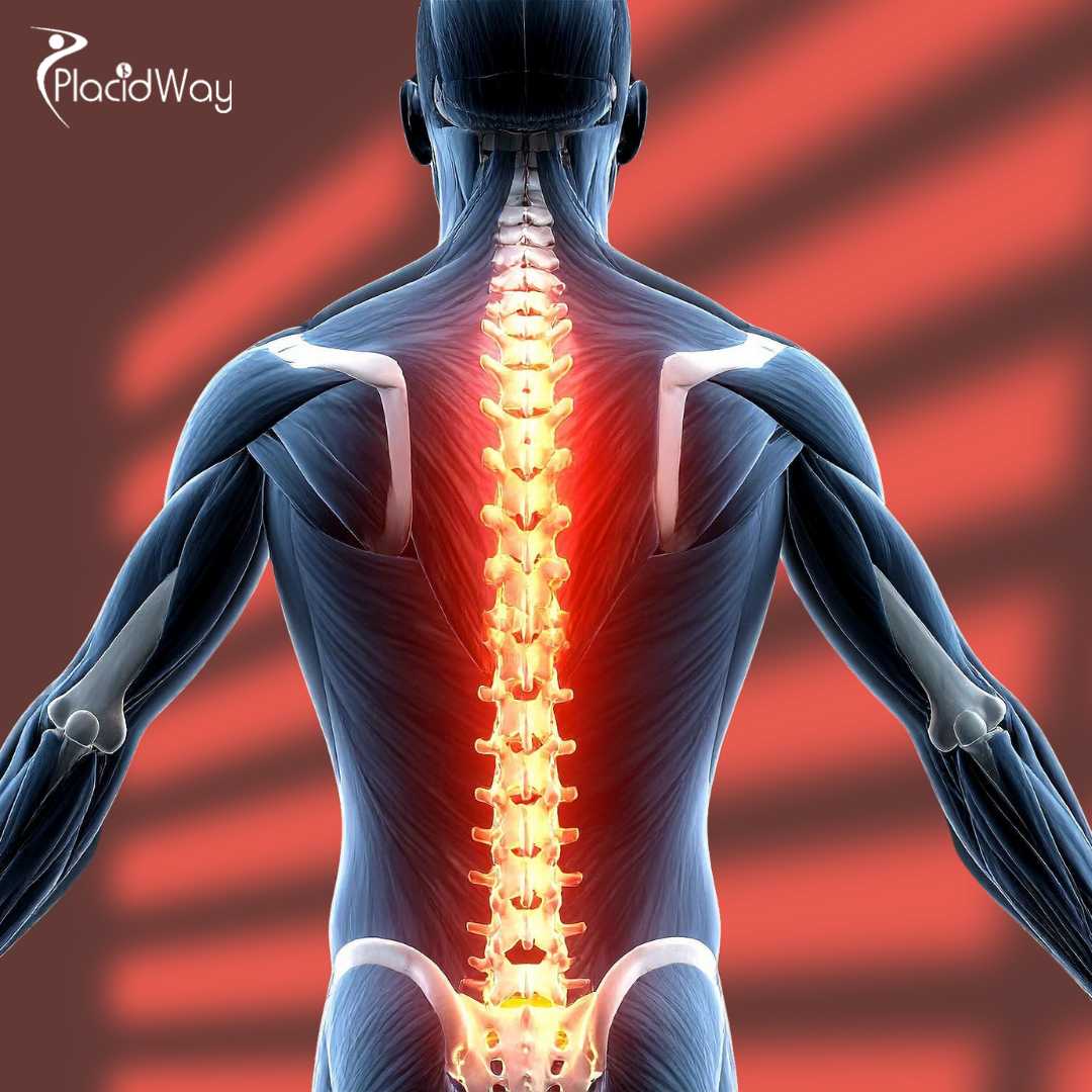 Rise Beyond Limits: Spinal Cord Injury Stem Cell Therapy in Malaysia Giving Hope to Patients from India