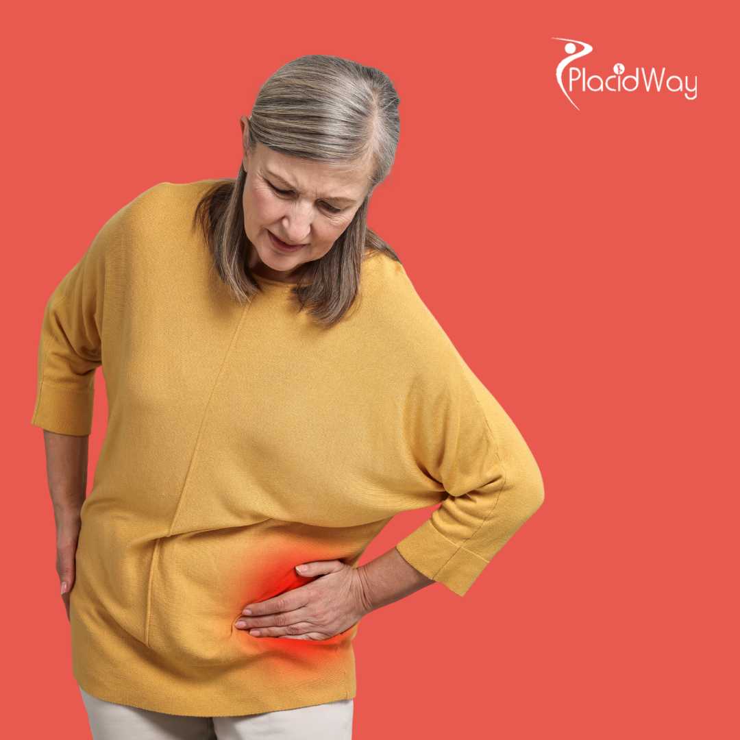 Stem Cell Therapy for Arthritis in Mexico for Toronto Patients