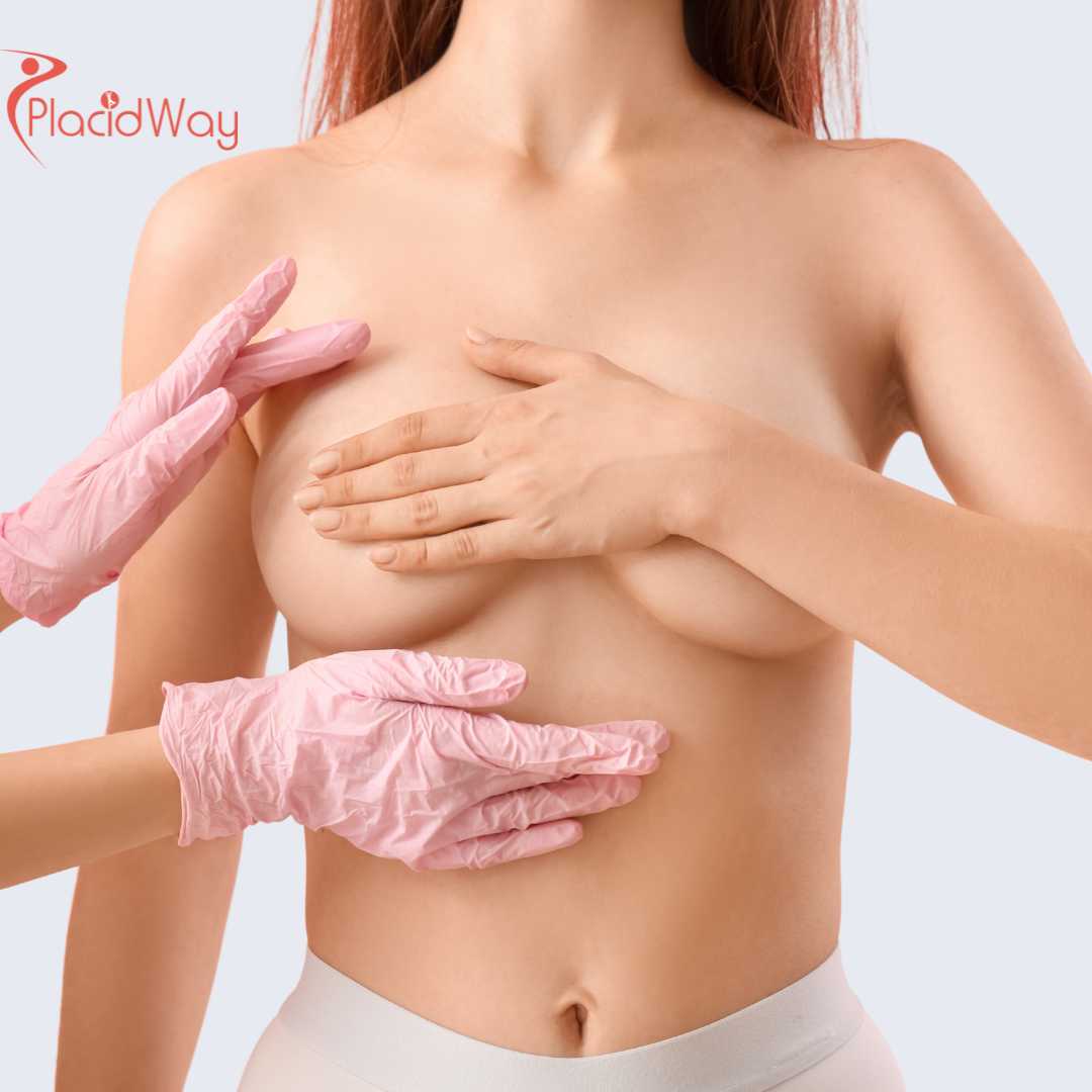 Breast Augmentation in Mexico for Toronto Patients Looking for Affordable Implants