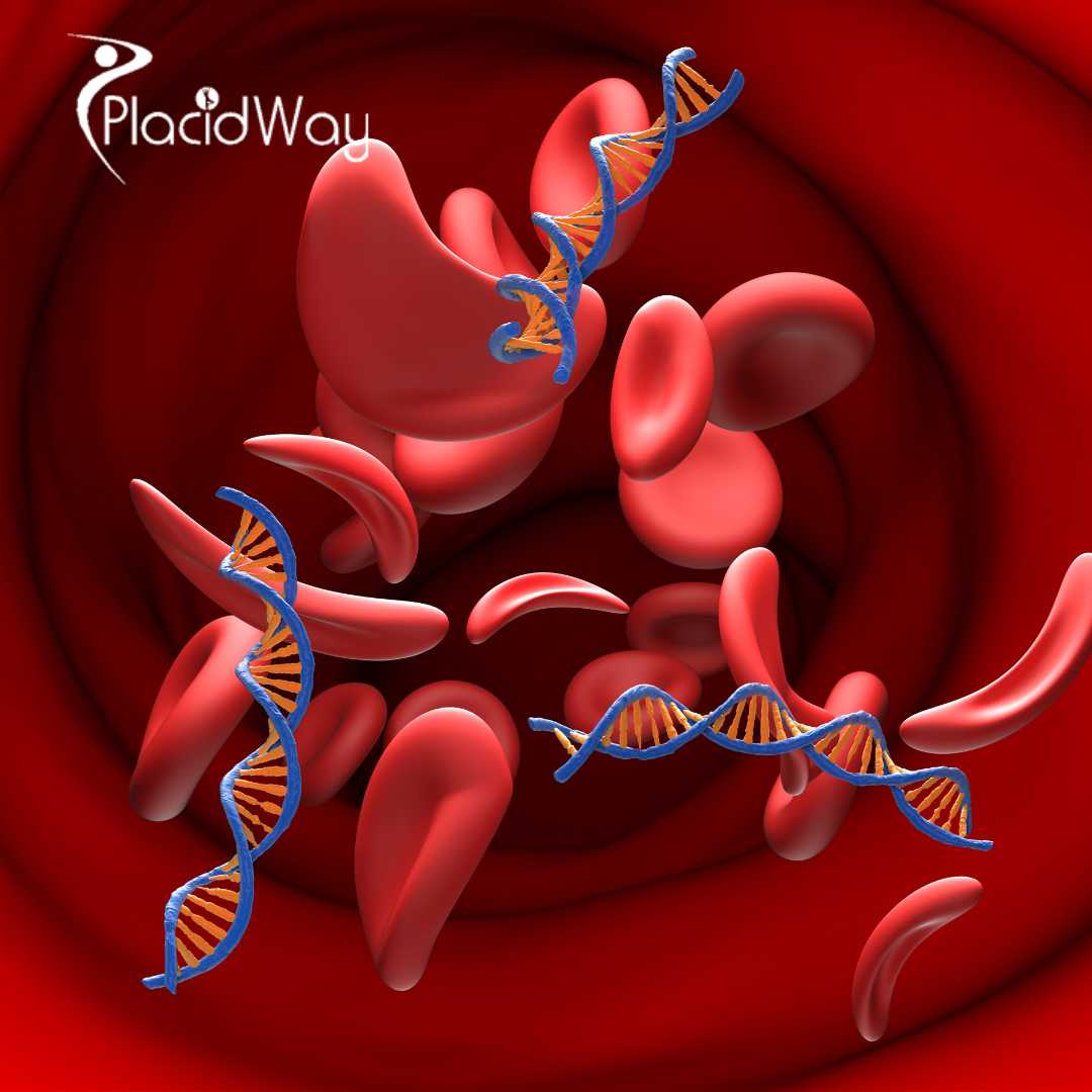 CAR-T Cell Therapy for Blood Cancer in China for Patients Seeking Advanced Cancer Immunotherapy
